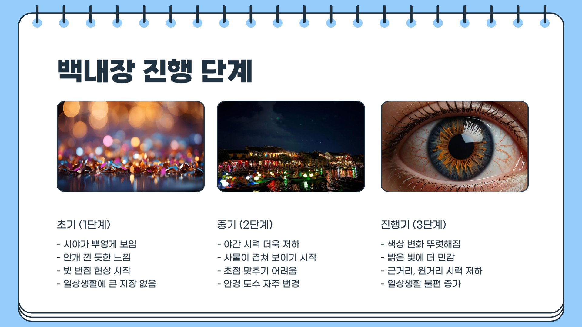 백내장 증상 치료