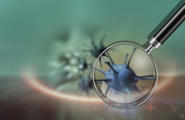 아나필락시스 증상