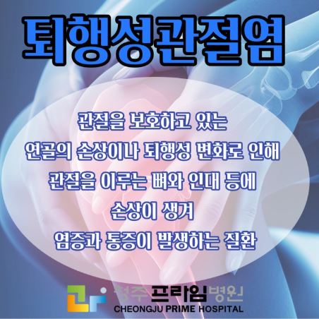 무릎줄기세포주사 병원추천 전국단위(서울,남양주,인천,용인,대전,청주,대구,부산)