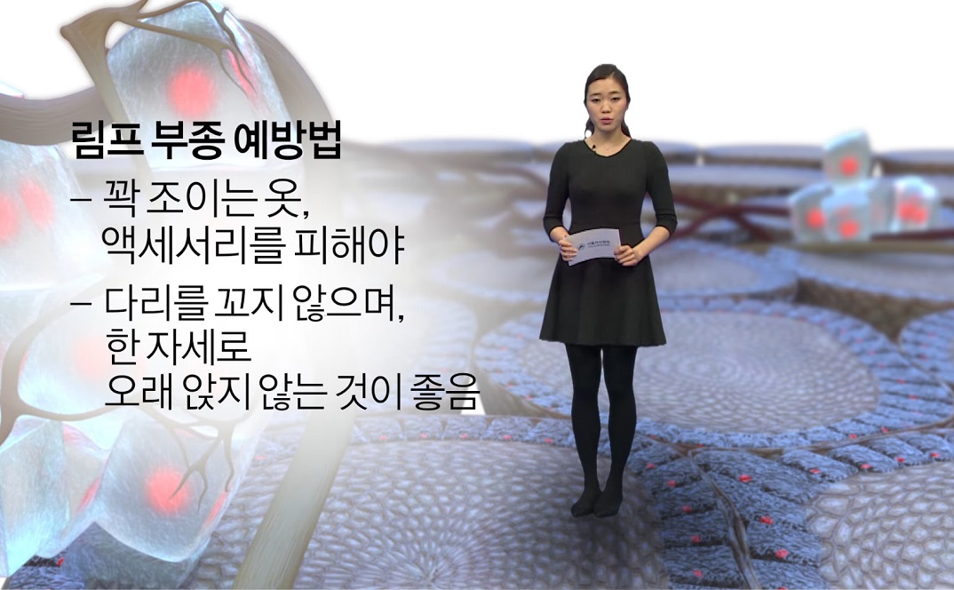 림프-부종-예방법