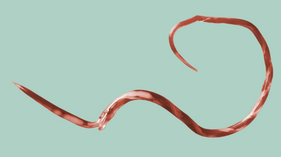 사람의 몸 속에 기생하고 있는 붉은 색의 기생충을 현미경으로 확대를 하여 찍은 사진