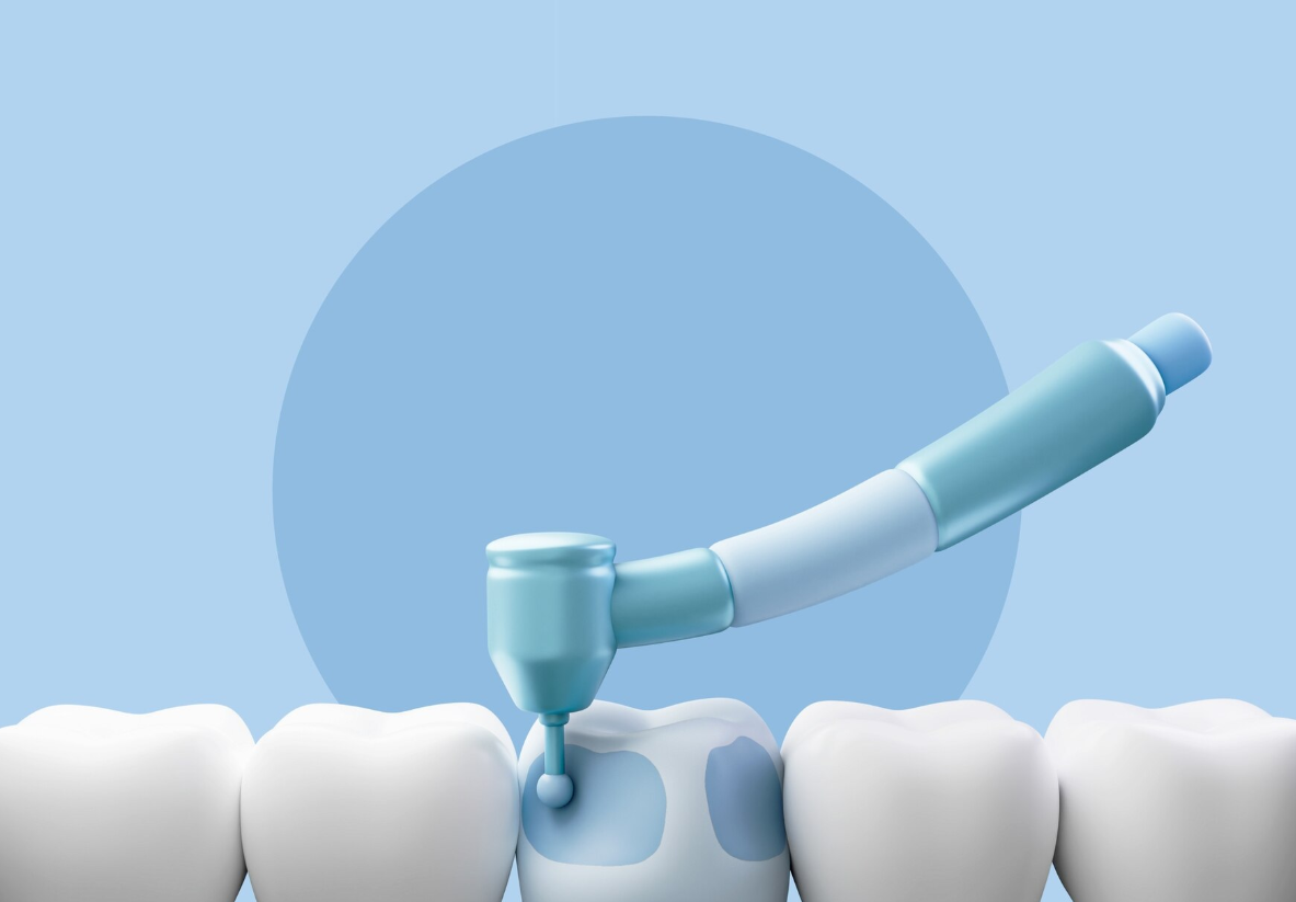 치과 진료비에 놀라셨나요? 지금 꼭 알아야 할 치과보험