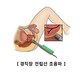 전립선암 증상