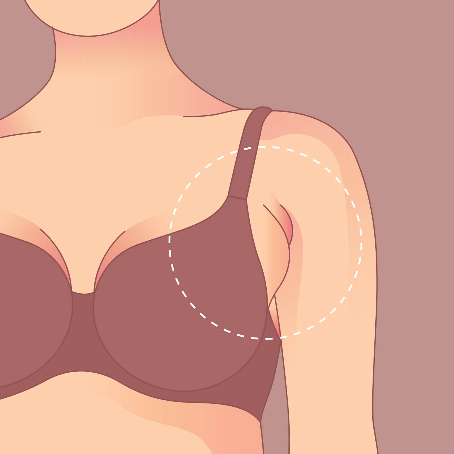 겨드랑이-멍울이-생긴-여성