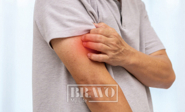 포진 관련 사진