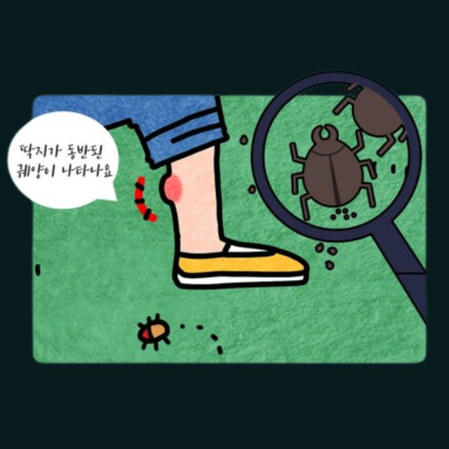 쯔쯔가무시 초기증상