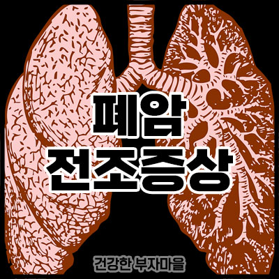 폐암 전조증상