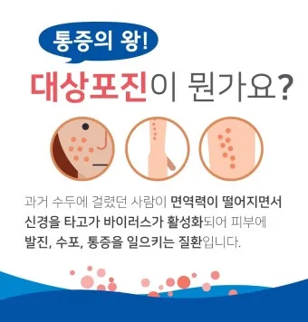 대상포진 치료방법에 대한 총정리 건강 질병관리_17