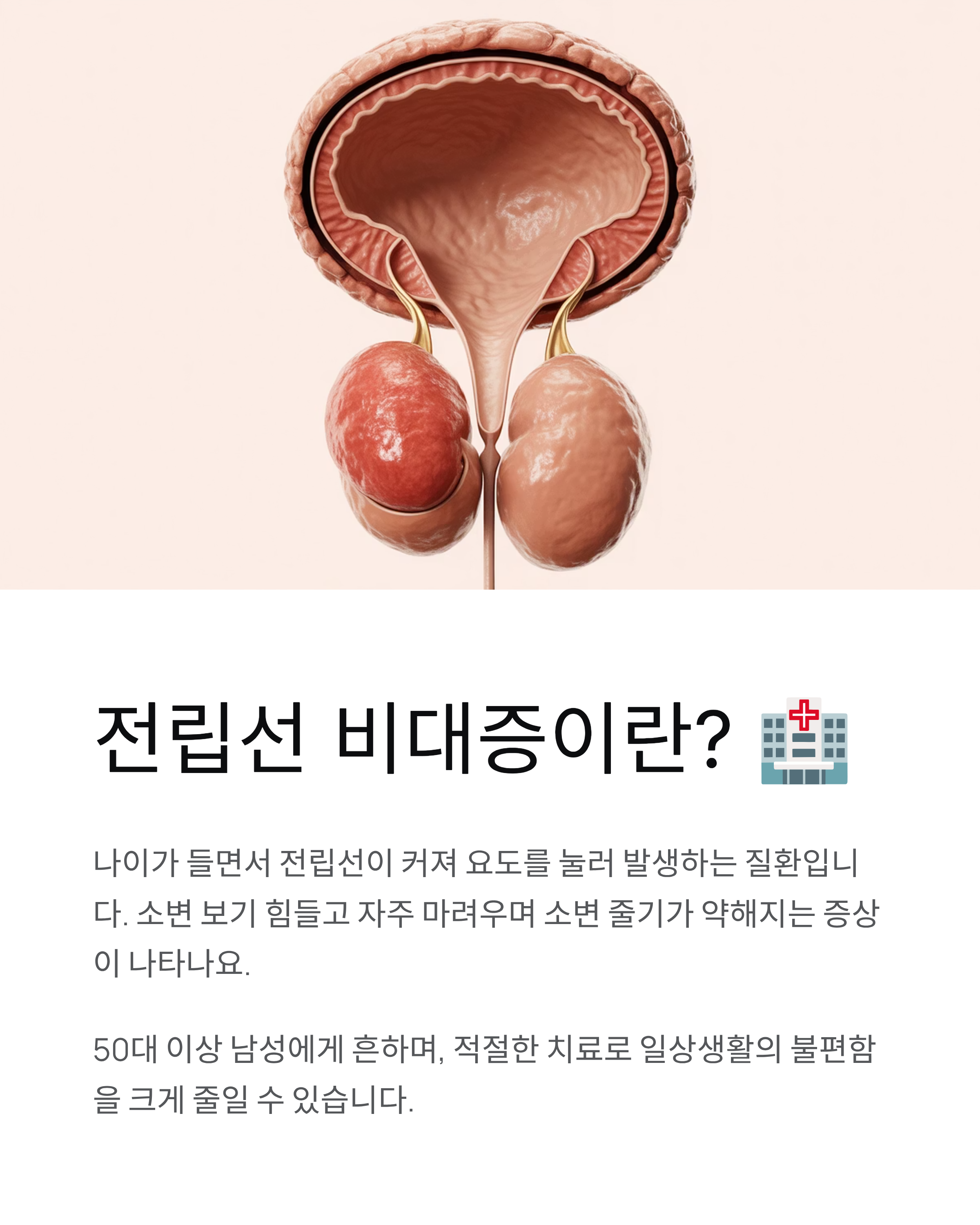 전립선 비대증 치료제 총정리약물별 효능과 부작용 완벽 가이드 💊