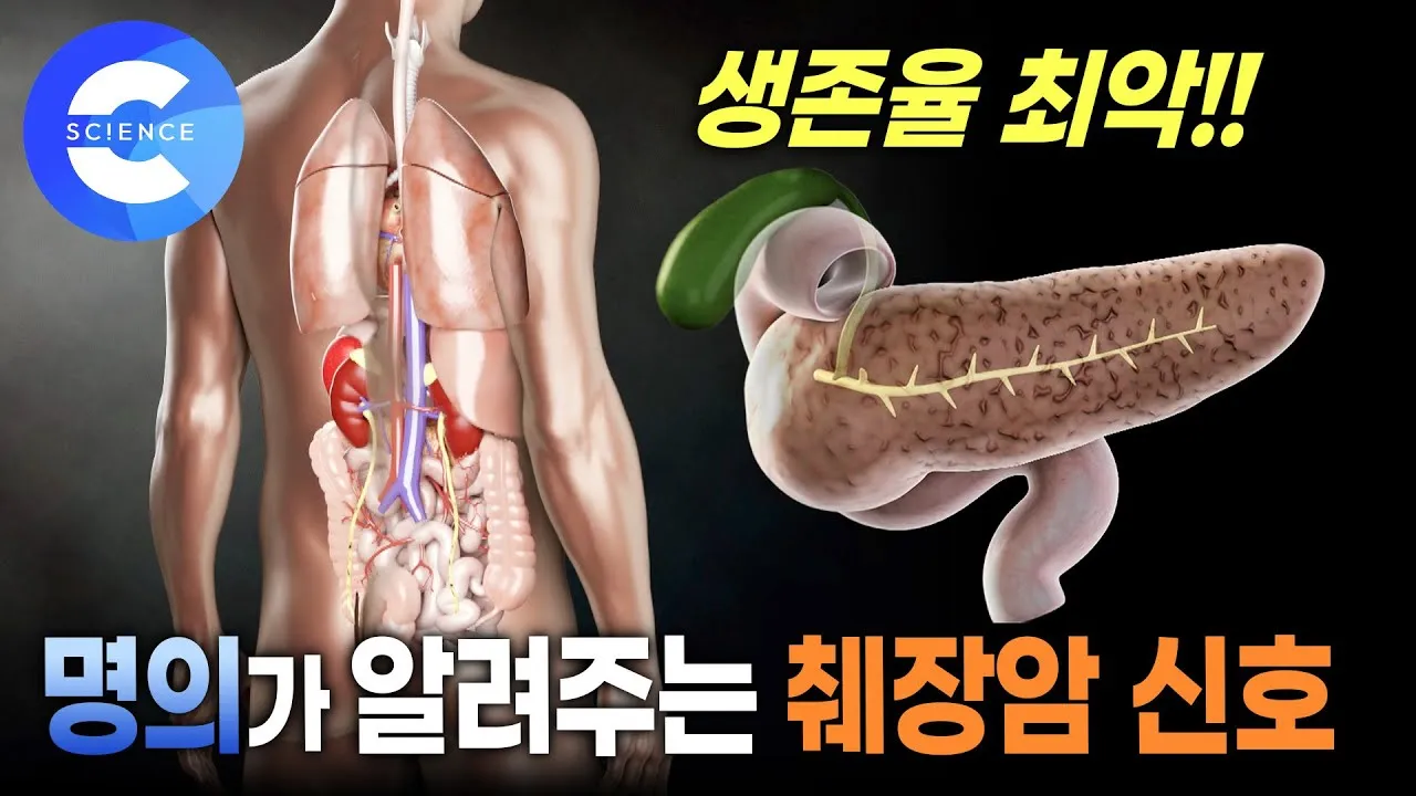 췌장암 초기 증상 췌장암 등통증 위치 검사_4