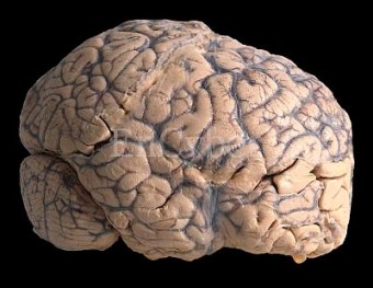 뉴스타트와 뇌 건강