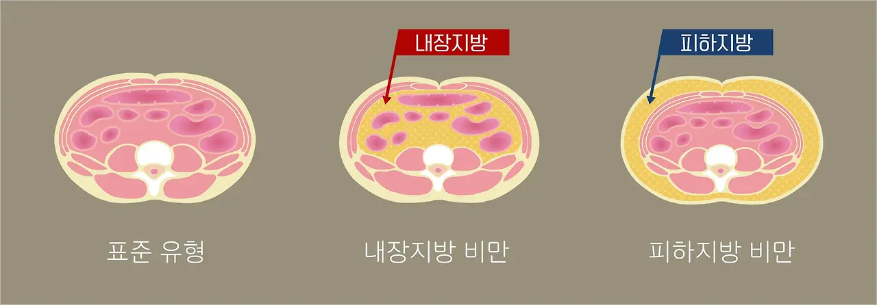 내장지방과-피하지방을-설명한-그림