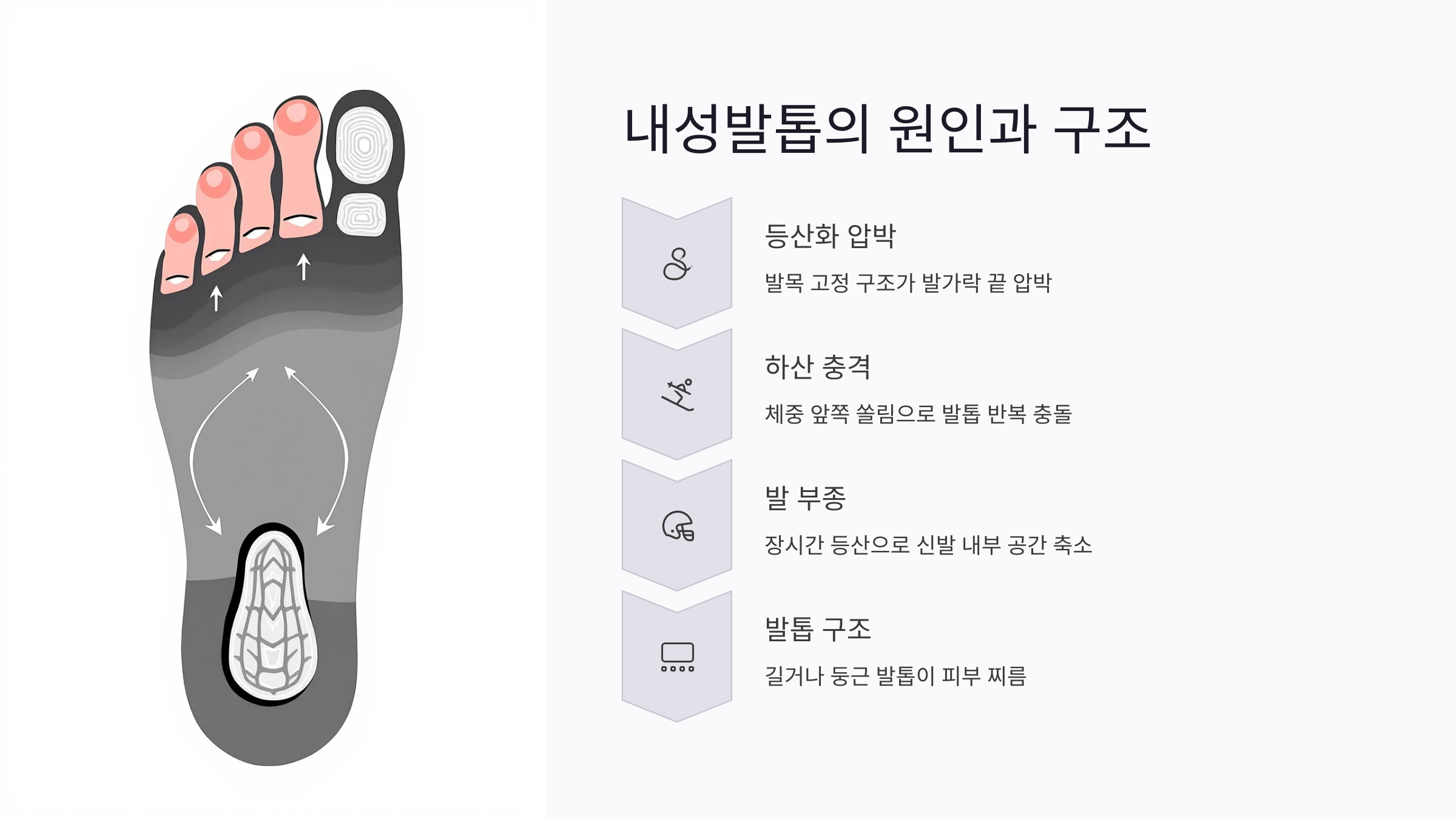 등산화 내성발톱의 원인과 압박 구조 이해