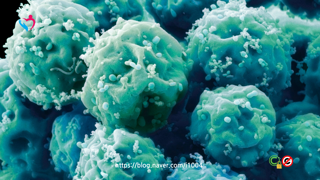 혈연관계는 없는 HLA 부분 일치 기증자로부터의 조혈모세포 이식, 치료 성적은?