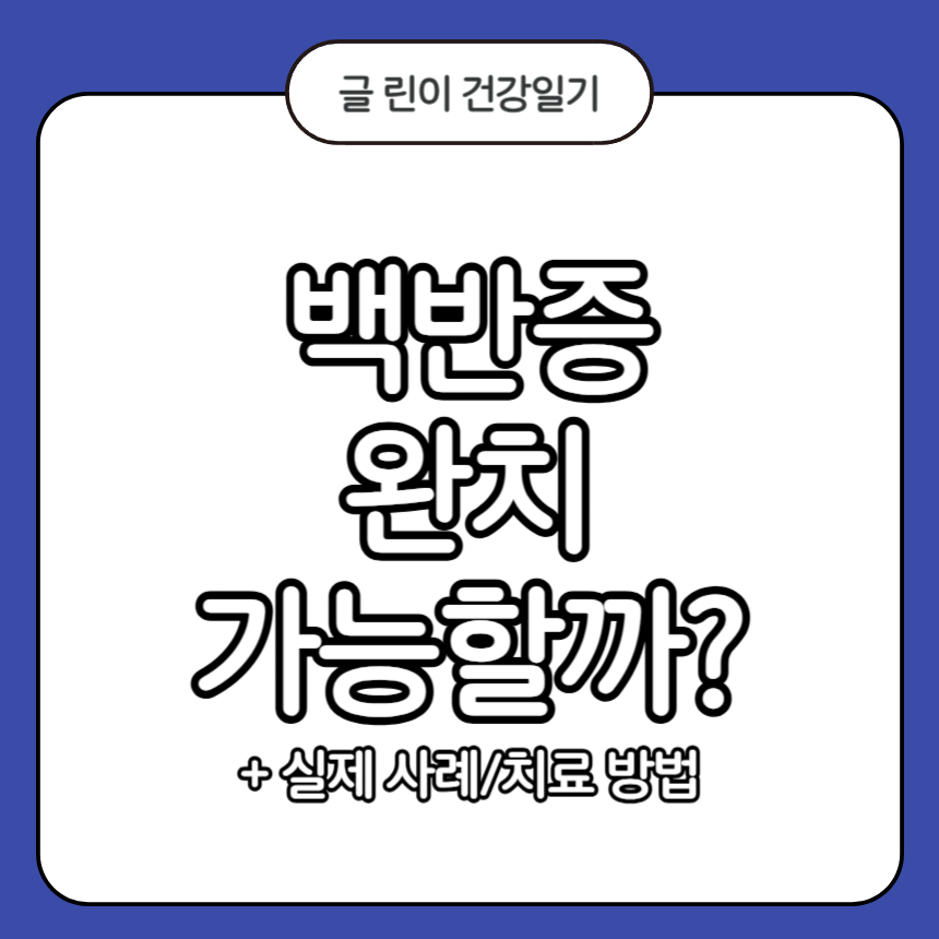 백반증 완치