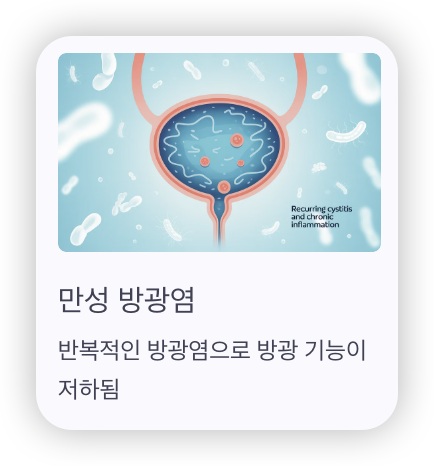 잔뇨감-지속되는-이유-만성-방광염