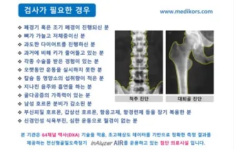 골밀도 검사 수치 골밀도 높이는 방법 간단 정리_19