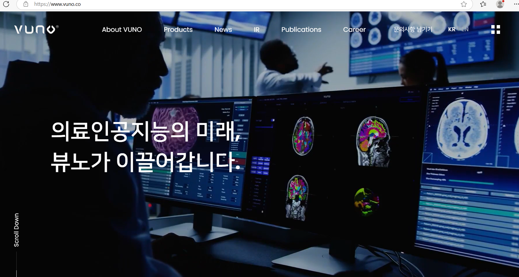 뷰노, VUNO Med, 치매 AI, AI 음성 진단