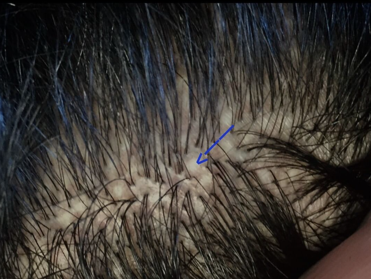  병원별 시술 방식&middot;비용 비교 (서울 강남/압구정)