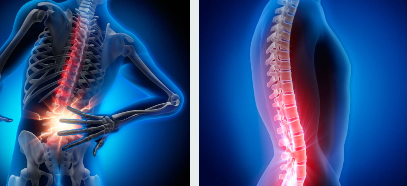 허리 디스크 통증