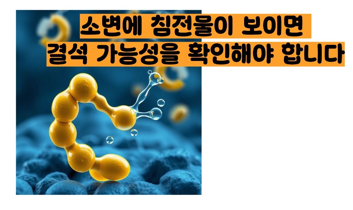 오줌이 탁한이유