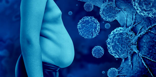 비만 지방 세포 암 발생 위험 종류 예방 식단 체질량지수 BMI 만성 염증 호르몬 변화 대장암 유방암 간암 자궁암 관리 운동