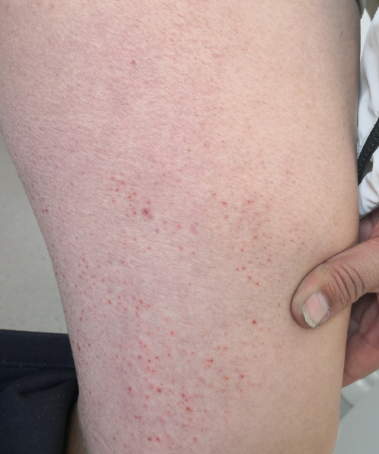 비판텐 가격은? 문제성 피부 조직 회복과 보습 효과를 가진 연고라 상비약으로 두기 딱 좋은 듯