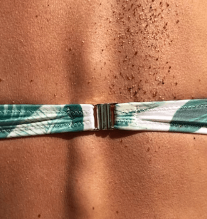 봉와직염 증상 - 청결 유지