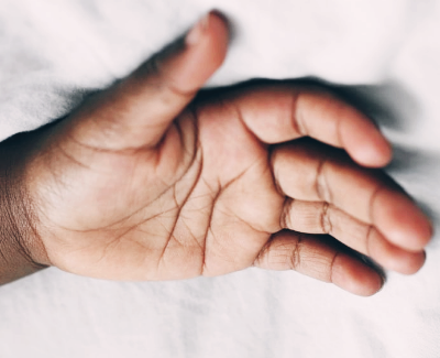 손이 붓는 이유와 증상, 손 부종 원인과 차이는?