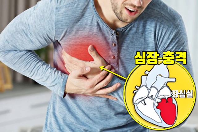 심한 스트레스 증상, 심근증, 가슴통증, 호흡곤란,건강 팁줌 매일꿀정보