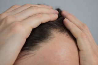 무분별한 셀프처방 허용