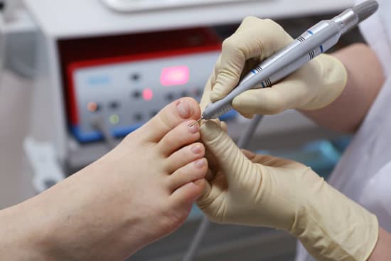 내성 발톱 제거술 (전층 발톱 제거술, Total Nail Avulsion) – 수술 과정 &amp; 회복 방법