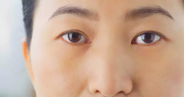 눈밑 꺼짐 없애는방법