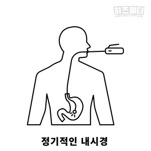 장상피화생