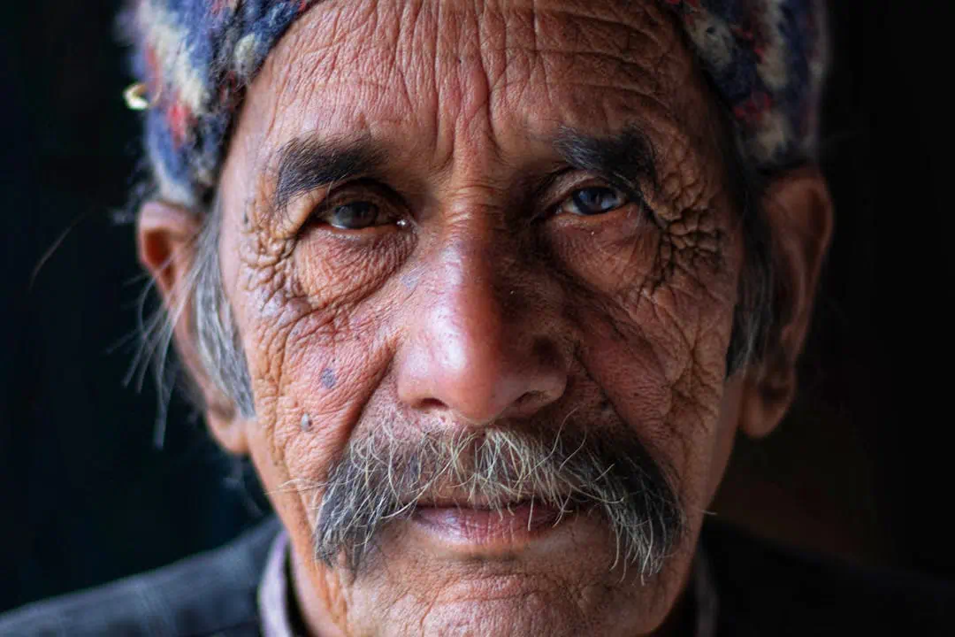 검버섯 가능성이 있는 노인의 모습2