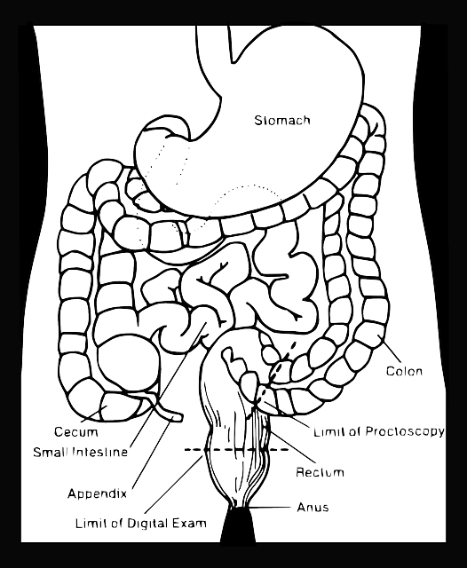 역류성-식도염-총정리-생활습관