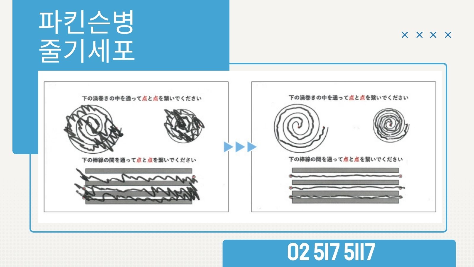 파칸슨병치료