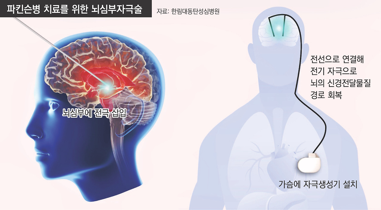 산정특례 신청 방법