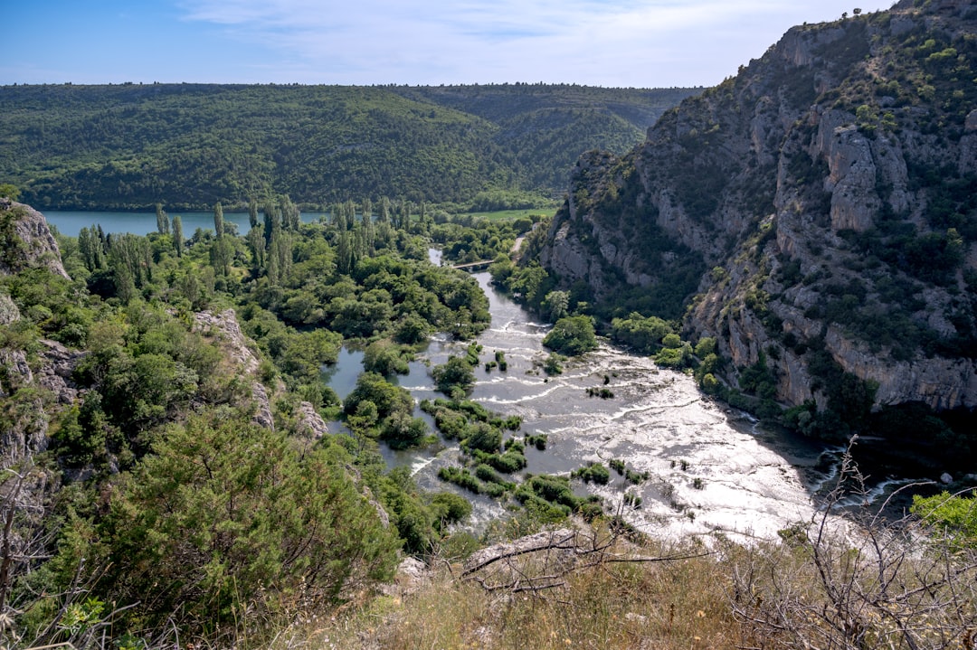 Cataract