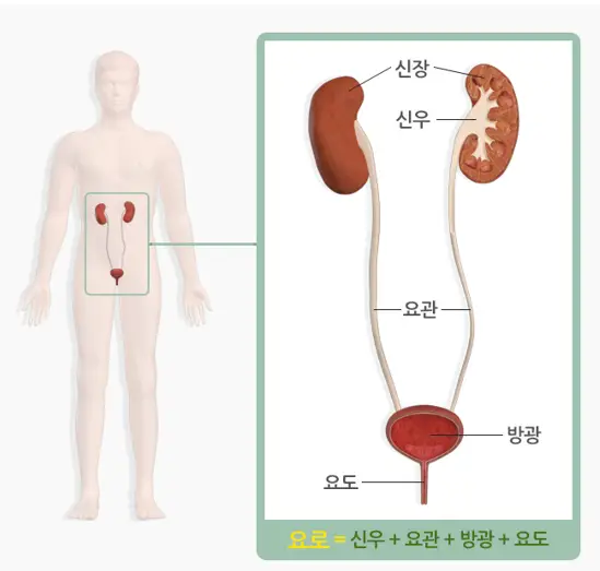 방광염