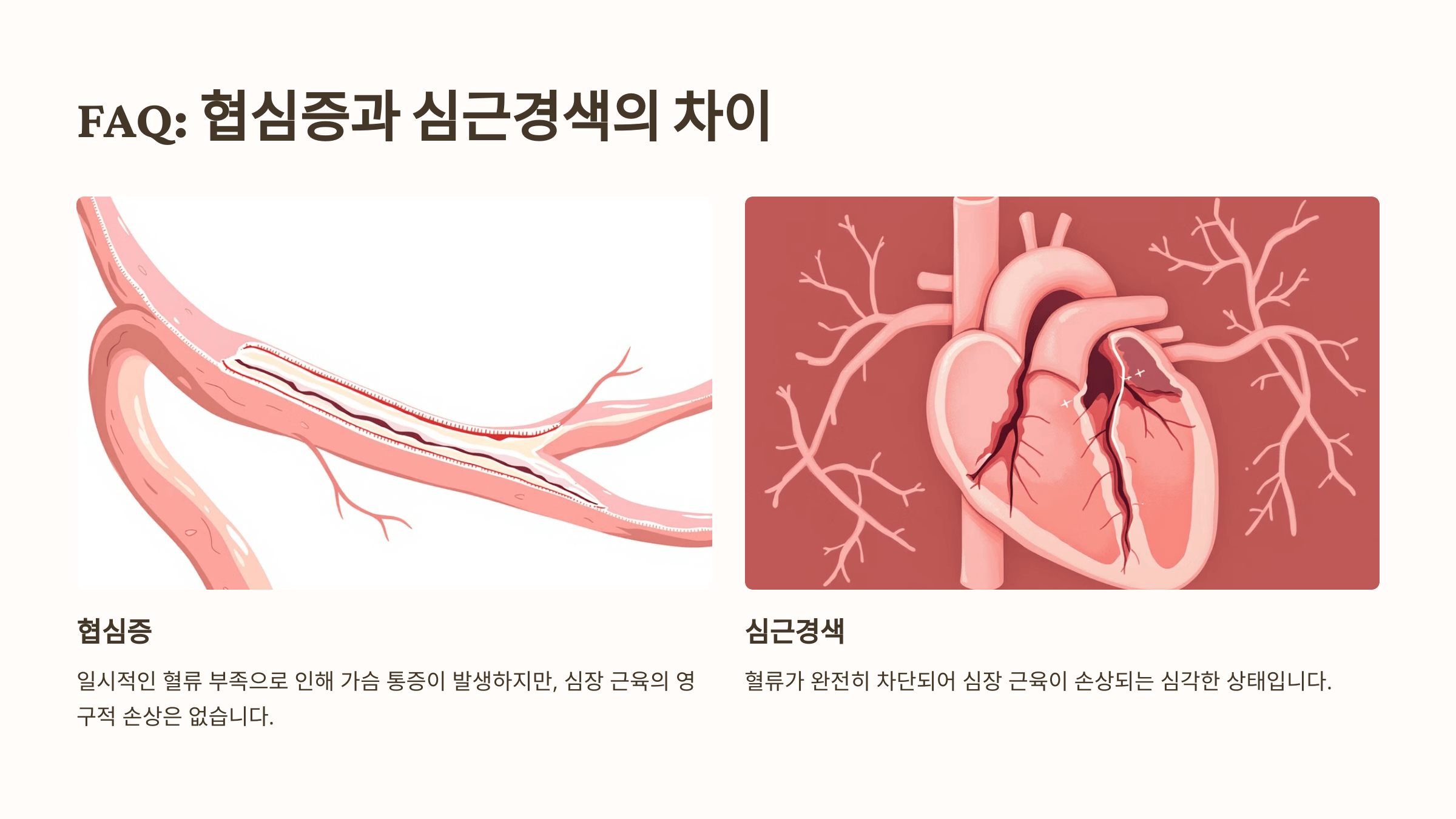 협심증과 관련된 사진입니다.