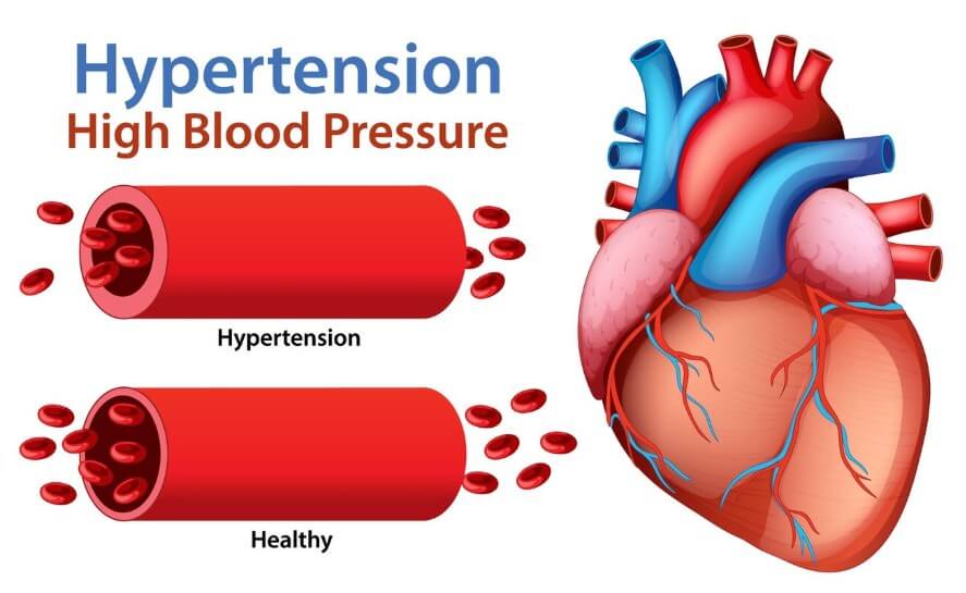 혈관 속 혈액의 속도