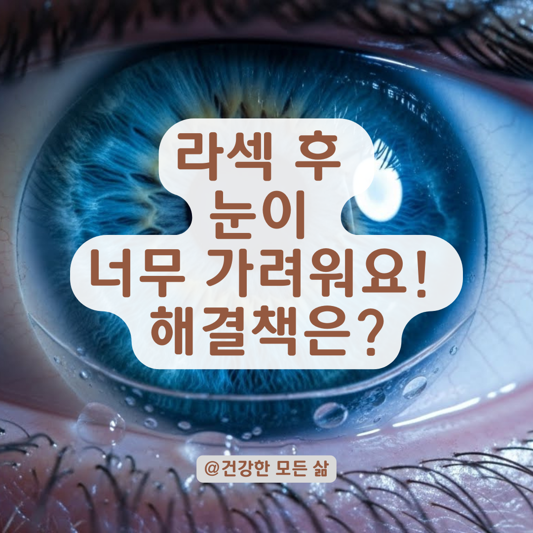 각막상피 재생술 후 찾아온 참을 수 없는 가려움? 긁으면 큰일 나요! 올바른 대처법 A to Z