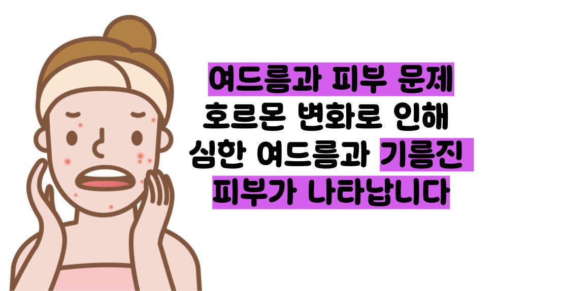다낭성 난소증후군 증상