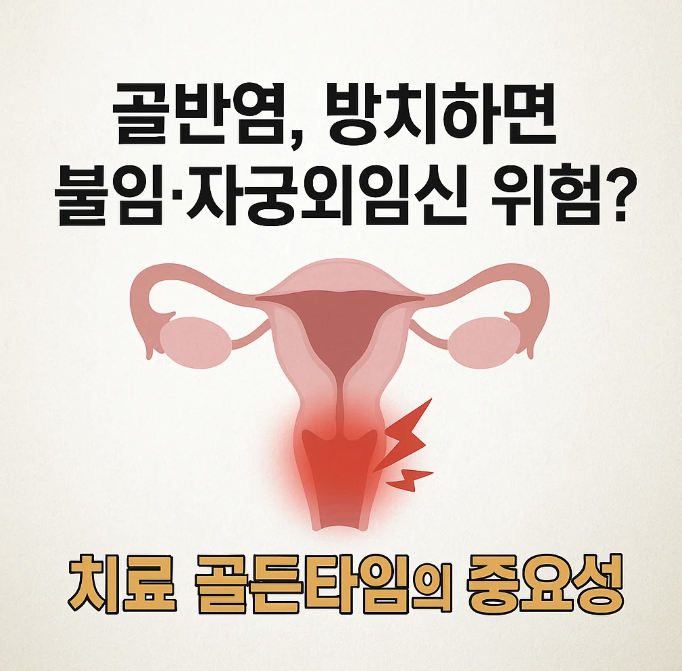 골반염, 방치하면 불임·자궁외임신 위험? 치료 골든타임의 중요성