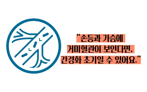 간경화 초기증상