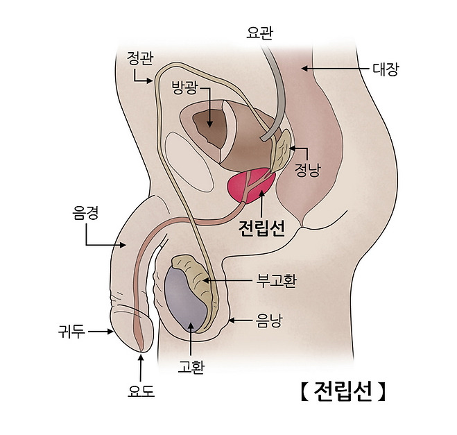 전립선 질환