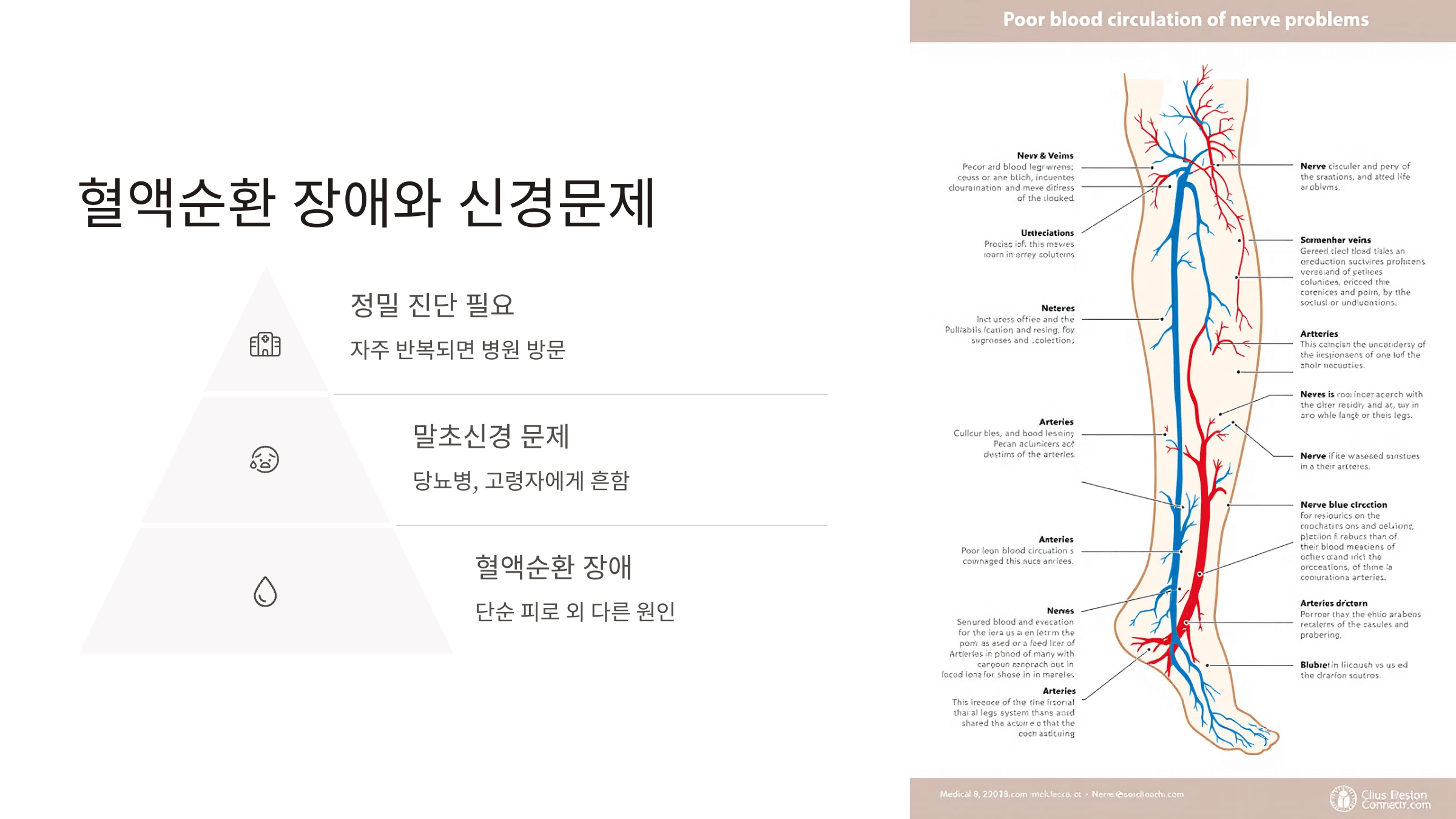 발바닥 사진입니다.
