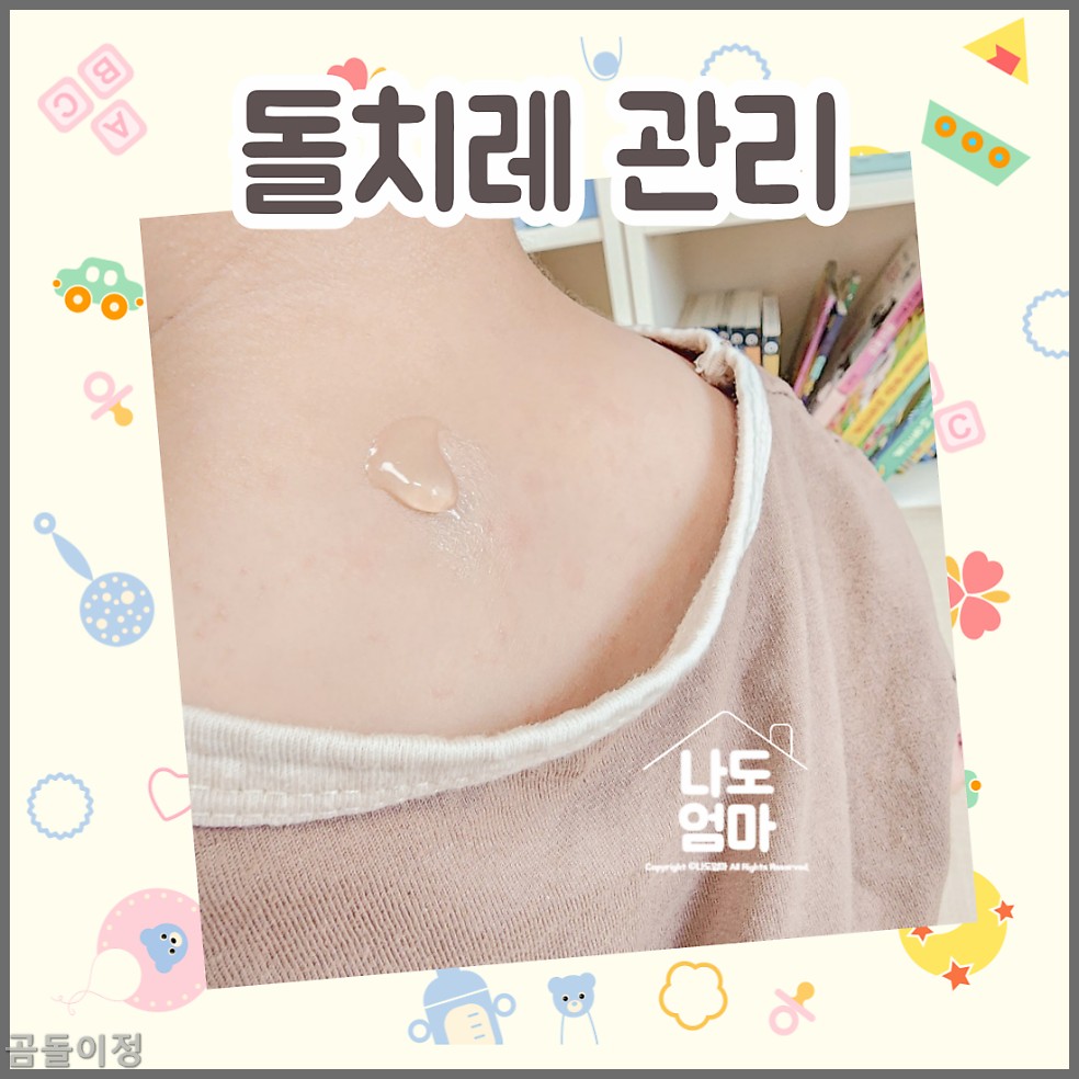 열꽃 두드러기 원인과 치료 방법, 아기 얼굴 관리 꿀팁