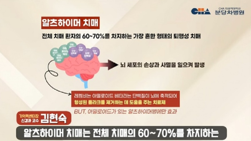 레카네맙-생로병사의비밀-치매-치료제-알츠하이머